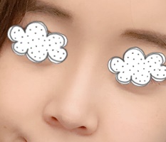 I started dating after nose surgery~
