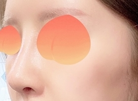 Hyundai Aesthetic Surgery is great for noses hehe