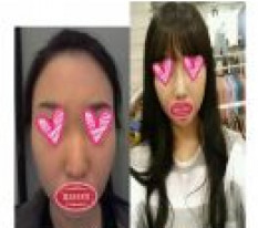 I got nose surgery and became a woman with a high nose bridge~