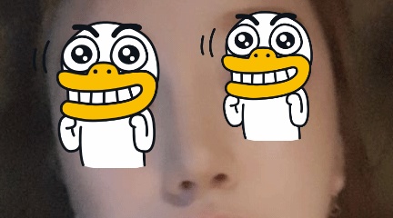 I got nose surgery at Hyundai Aesthetic Surgery^^