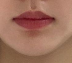 Overcoming my lip complex.. haha
