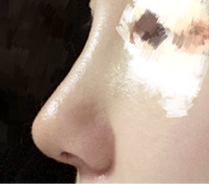 My nose became really pretty