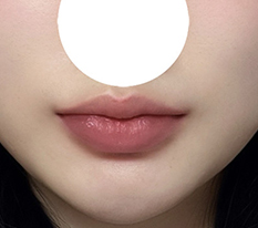 Natural and pretty lips