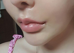 My mouth corners changed completely!!