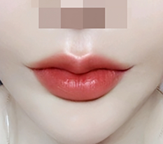 My mouth corners got pretty lol