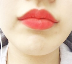 Raised my mouth corners + lip peaks~♥