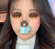 My redone cheekbone surgery looks pretty^^