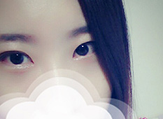 Eye surgery is the best ㅋ