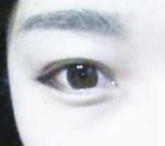 Double eyelids are definitely.. incisional lol