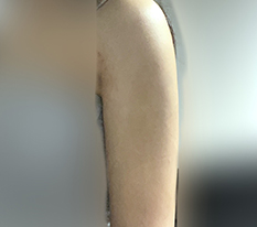 A delicate arm line