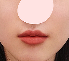 Finally escaped my gizzard-like lipsㅠㅠㅠ