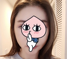 I solved my stressful cheekbones at Hyundai Aesthetic Surgery^.^