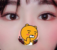 Back and lower canthoplasty are here