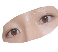My eye and nose surgery turned out amazing!!!