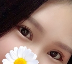My eyes look clear again