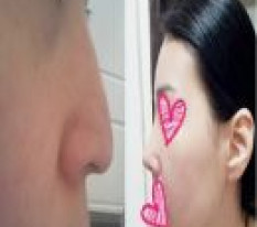 A High and Straight Nose Bridge!!