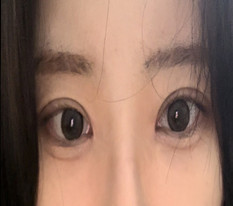 I have absolutely huge eyes now!