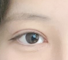 After double-eyelid surgery, I am living a new lifeㅠㅠ
