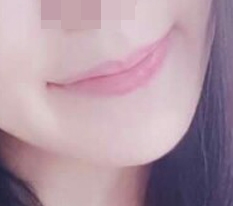 Sexy mouth corners