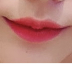 My impression changed a lot after mouth-corner surgery haha