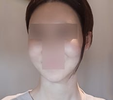 My face shape is back ㅎㅎ