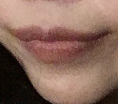 I can smile confidently thanks to my mouth corners