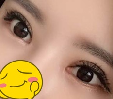 My eyes became perfect!