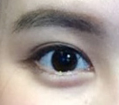 They really deserved to be called the place for double eyelids and canthoplasty lol
