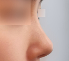 Nose line is great