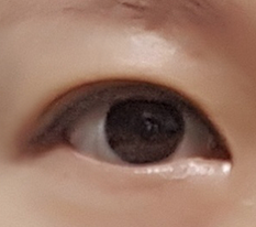 4 months after ptosis correction and double eyelids~^^