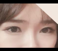 My eye correction review~