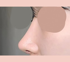 Hyundai Aesthetic Surgery is a go-to spot for nose jobs 👍