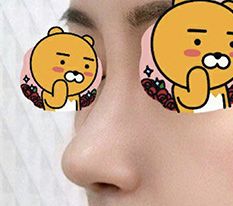 I had no idea the satisfaction from nose revision surgery would be this high lol