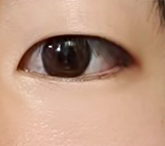 When the eyes change
