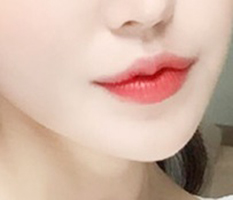 I admit the natural result ^3^