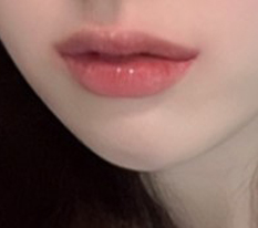 My lip concerns are over