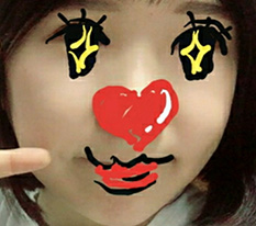 My cheekbone surgery turned out well, right?