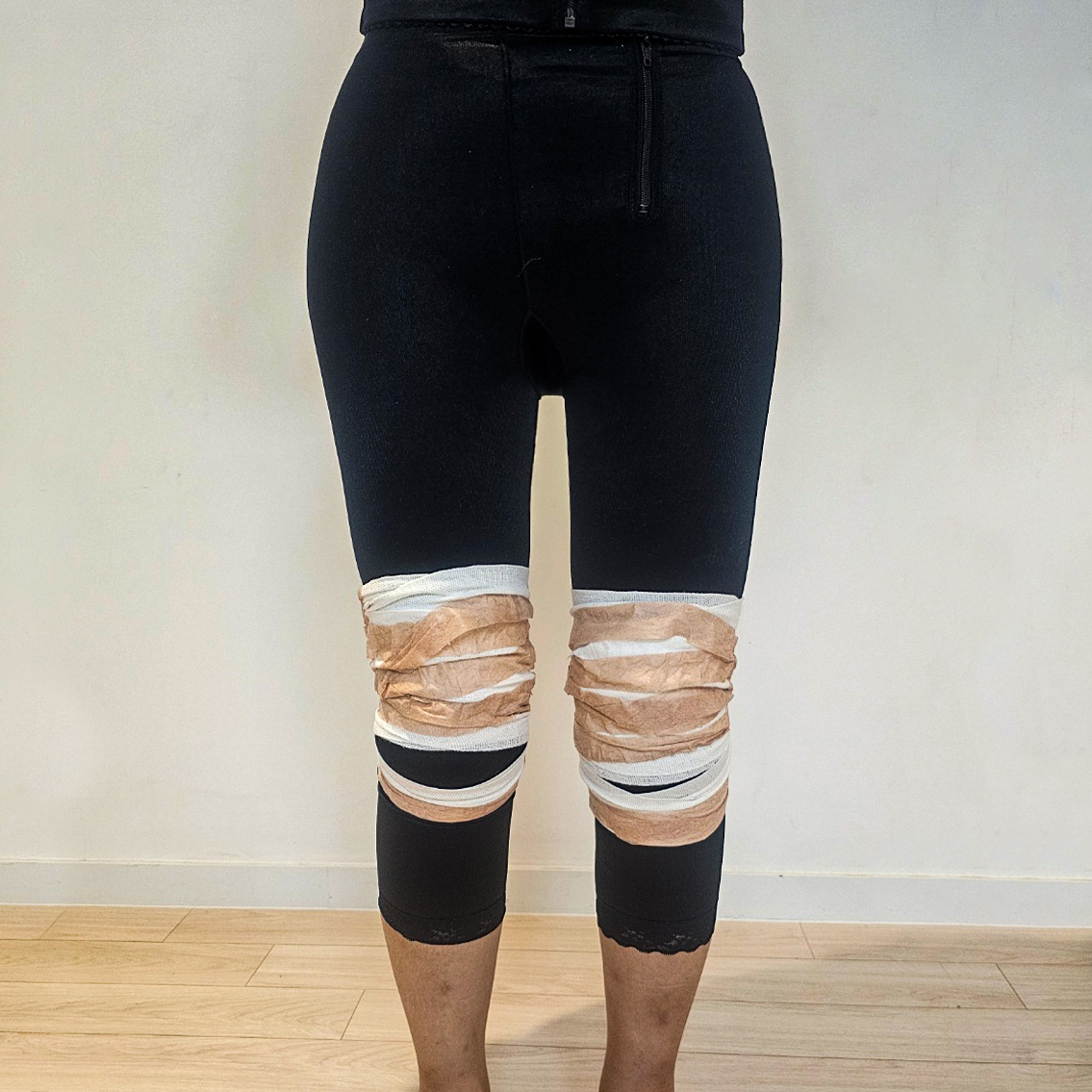 Review of thigh, hip, and knee liposuction