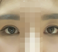 My eyes changed so much I barely recognize myself