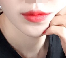 My mouth corners are amazing~~!!!