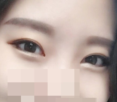 Perfect Big Eye is the best><b