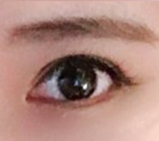 Finally found the eye-surgery place and succeeded!