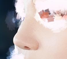 I Got Nose Surgery