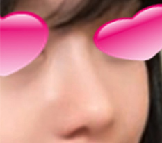 My whole vibe changed after rhinoplasty