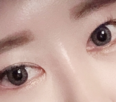 Had canthoplasty revision ~.~ Hyundai Aesthetic Surgery approved ♡♡