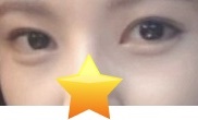 Finally free from asymmetrical eyes ㅋㅋ