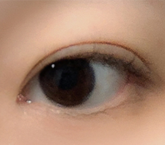 My eye worries are over!!!
