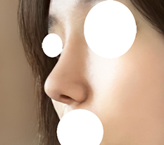 Nose-Tip Detail Is Great