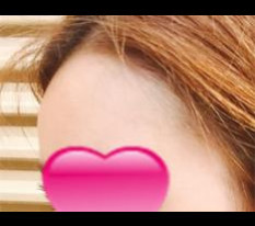 My forehead became nice and rounded!