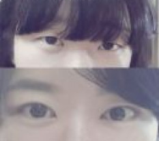 They Say I Got Pretty After Eye Surgery~ haha
